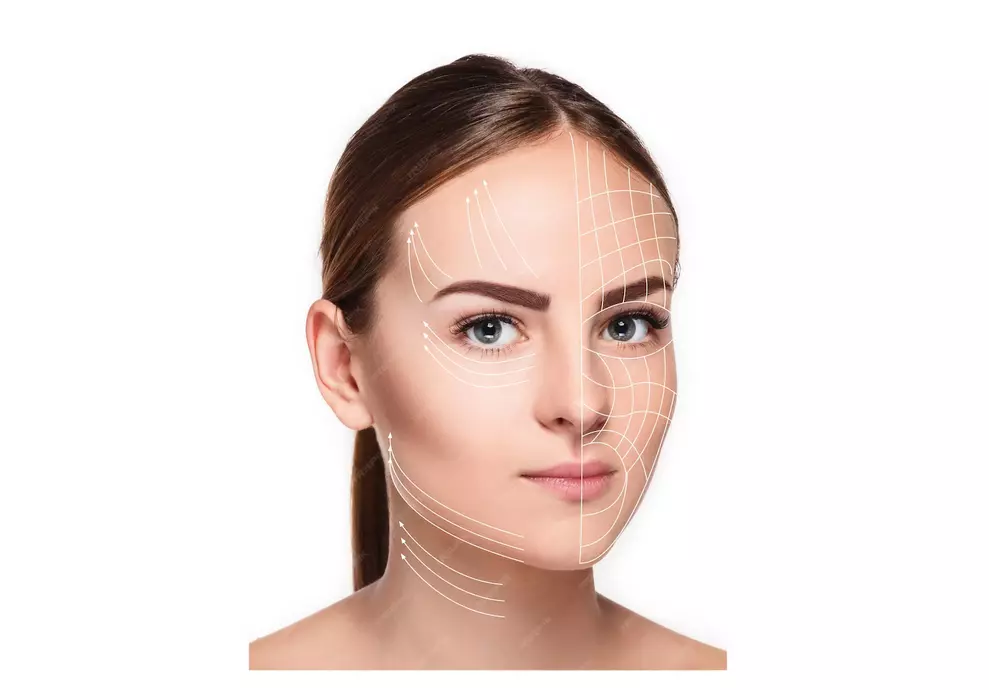 روتز صورت برای اصلاح ناهمواری‌ها، فرورفتگی‌ها و برجستگی‌های چهره استفاده می‌شود. 